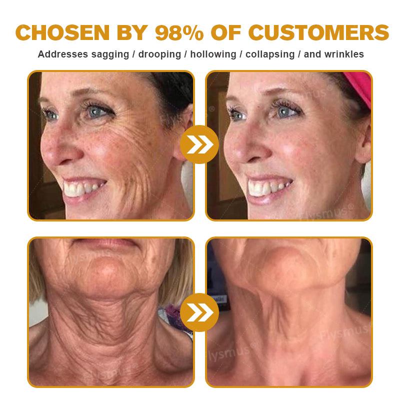 👨‍⚕️Made and shipped from the UK✅-Flysmus® Botox Bee Venom Wrinkle Removal Cream-Last Day Promotion 70% OFF