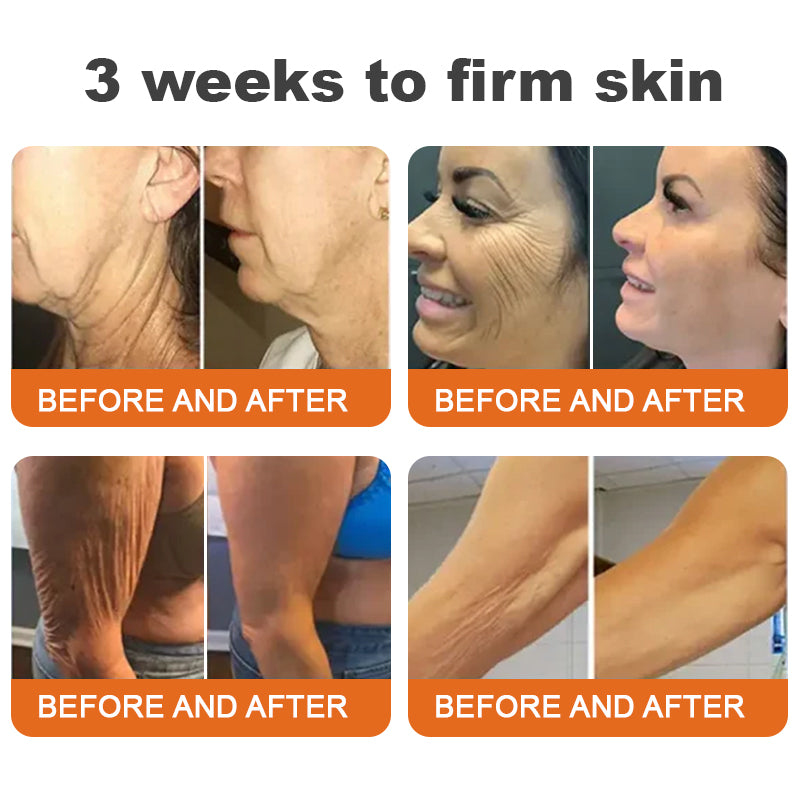 👨⚕️💎✨Made and Shipped from UK✨Flysmus™ Botox Bee Venom Firming Serum Stick🔥LAST DAY 70% OFF