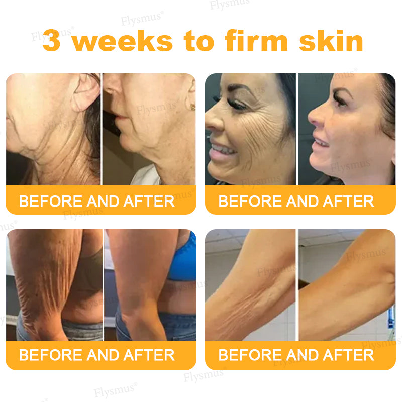 ✨Made and shipped from the UK👨⚕️ Flysmus® Botox Bee Venom Wrinkle Firming Multi-Purpose Cream