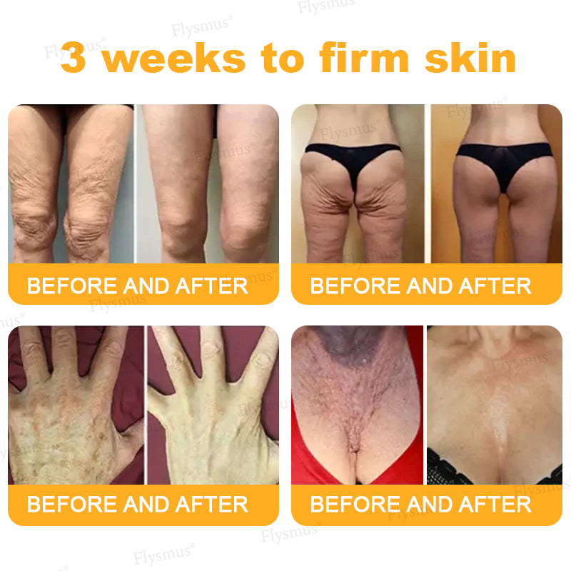 ✨Made and shipped from the UK👨⚕️ Flysmus® Botox Bee Venom Wrinkle Firming Multi-Purpose Cream