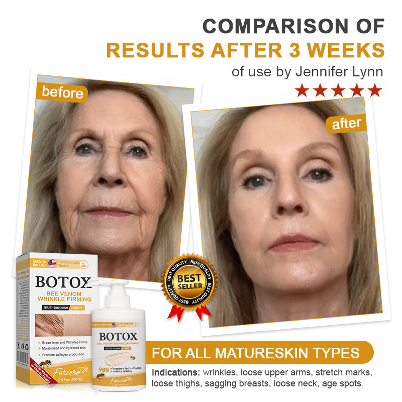 ✨Made and shipped from the UK👨⚕️ Flysmus® Botox Bee Venom Wrinkle Firming Multi-Purpose Cream