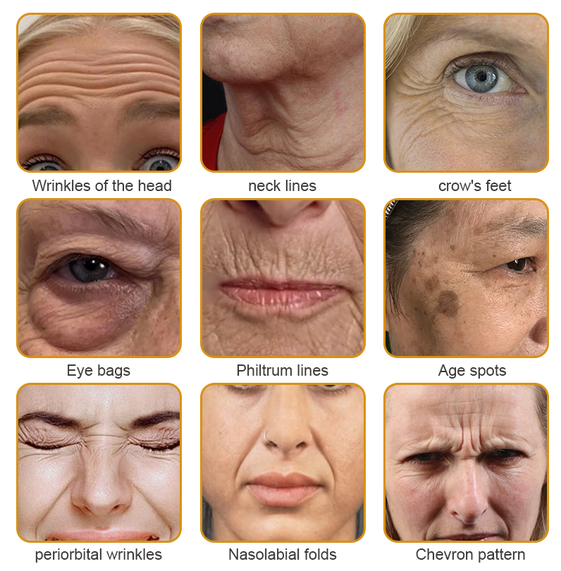 👨⚕️🌿Made and shipped from the UK✨Flysmus® Botox Bee Venom Wrinkle Removal Cream-Last Day Promotion 70% OFF