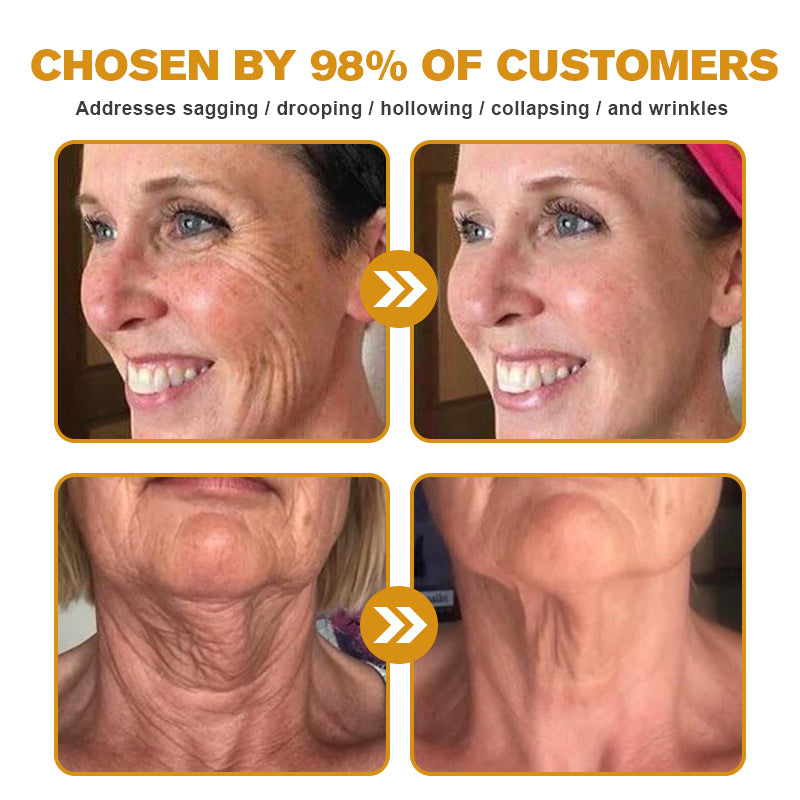 (✅MHRA Approved👩⚕️)-Furzero™ Botox Bee Venom Wrinkle Removal Cream-Last Day Promotion 70% OFF