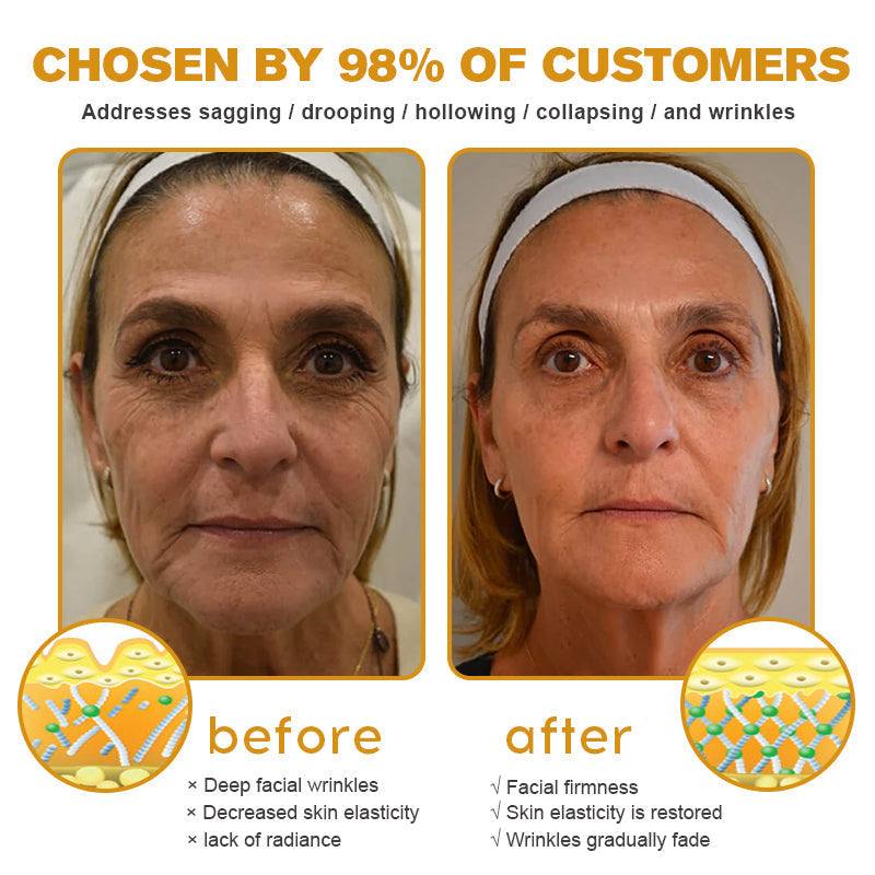 (✅MHRA Approved👩⚕️)-Furzero™ Botox Bee Venom Wrinkle Removal Cream-Last Day Promotion 70% OFF