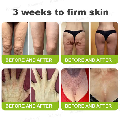 ✅👨‍⚕️✨Made and shipped from the UK 💫Rolimey® Botox & Vita-A Retinol Shot Wrinkle-Lift Tightening Serum - Last Day Promotion 70% OFF