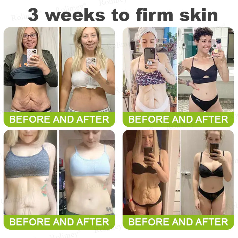 ✅👨‍⚕️✨Made and shipped from the UK 💫Rolimey® Botox & Vita-A Retinol Shot Wrinkle-Lift Tightening Serum - Last Day Promotion 70% OFF