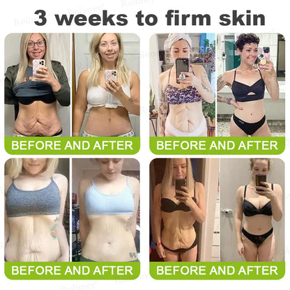 ✅👨‍⚕️✨Made and shipped from the UK 💫Rolimey® Botox & Vita-A Retinol Shot Wrinkle-Lift Tightening Serum - Last Day Promotion 70% OFF