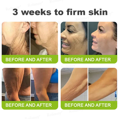 ✅👨‍⚕️✨Made and shipped from the UK 💫Rolimey® Botox & Vita-A Retinol Shot Wrinkle-Lift Tightening Serum - Last Day Promotion 70% OFF