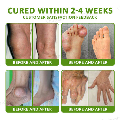 👨‍⚕️☘️Made and Shipped from the UK ✅Ourlyard® Magnesium & Peppermint Arthritis Pain Relief and Bone Healing Cream(✅Quick and lasting solution to arthritis, rheumatism, muscle spasms, sports injuries) 🔥LAST DAY 70% OFF