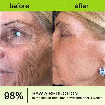 💎✅Made and shipped from the UK 💫Rolimey® Botox & Vita-A Retinol Shot Wrinkle-Lift Tightening cream - Last Day Promotion 70% OFF