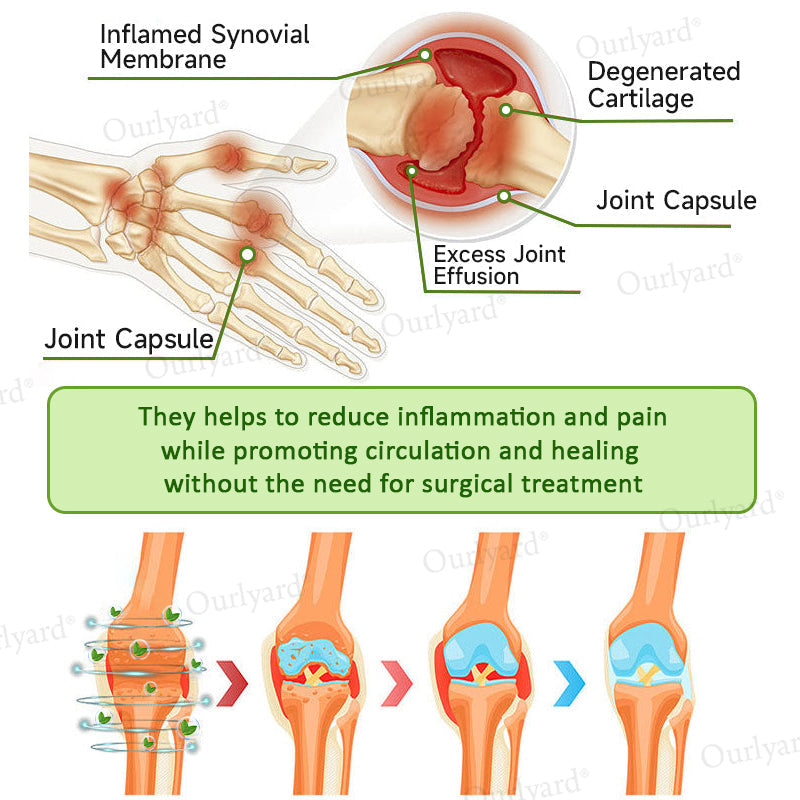 👨‍⚕️☘️Made and Shipped from the UK ✅Ourlyard® Magnesium & Peppermint Arthritis Pain Relief and Bone Healing Cream(✅Quick and lasting solution to arthritis, rheumatism, muscle spasms, sports injuries) 🔥LAST DAY 70% OFF