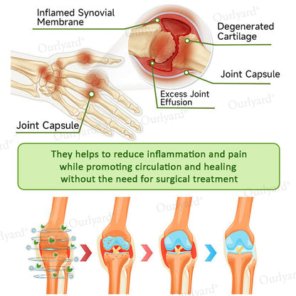 👨‍⚕️☘️Made and Shipped from the UK ✅Ourlyard® Magnesium & Peppermint Arthritis Pain Relief and Bone Healing Cream(✅Quick and lasting solution to arthritis, rheumatism, muscle spasms, sports injuries) 🔥LAST DAY 70% OFF