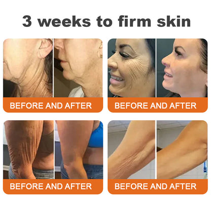 💝🐝Made and Shipped from UK✨Flysmus™ Botox Bee Venom Firming Serum Stick🔥LAST DAY 70% OFF
