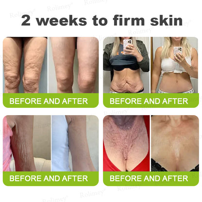 💎✅Made and shipped from the UK 💫Rolimey® Botox & Vita-A Retinol Shot Wrinkle-Lift Tightening cream - Last Day Promotion 70% OFF