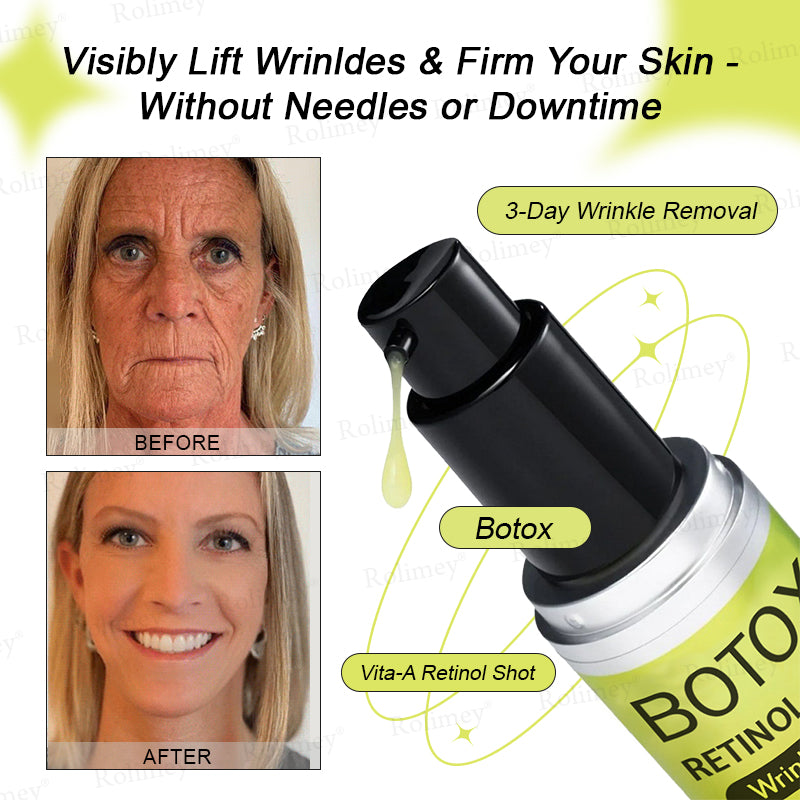 ✅👨‍⚕️✨Made and shipped from the UK 💫Rolimey® Botox & Vita-A Retinol Shot Wrinkle-Lift Tightening Serum - Last Day Promotion 70% OFF