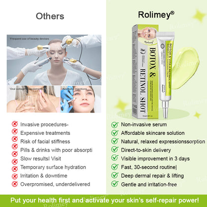 ✨✅Made and shipped from the UK 💫Rolimey® Botox & Vita-A Retinol Shot Wrinkle-Lift Tightening cream - Last Day Promotion 70% OFF