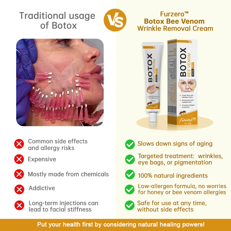 (✅MHRA Approved👩‍⚕️)-Furzero™ Botox Bee Venom Wrinkle Removal Cream-Last Day Promotion 70% OFF
