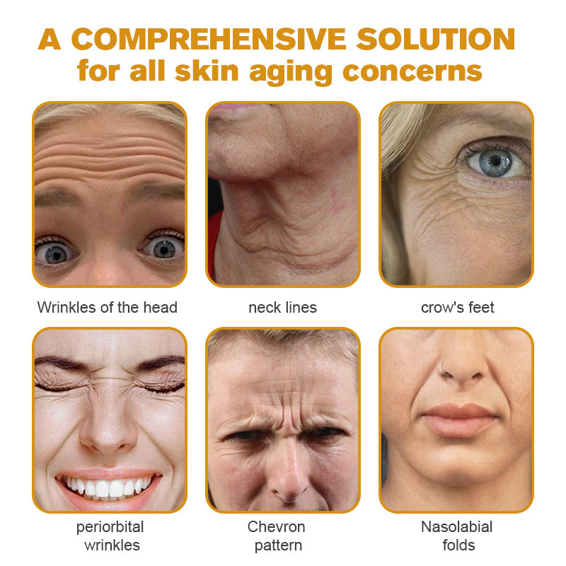 (✅MHRA Approved👩‍⚕️)-Furzero™ Botox Bee Venom Wrinkle Removal Cream-Last Day Promotion 70% OFF