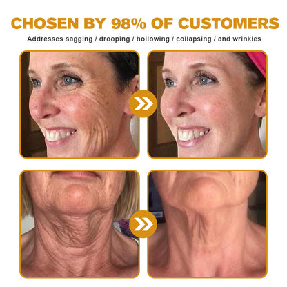 💎👨‍⚕️Made and shipped from the UK✨Flysmus® Botox Bee Venom Wrinkle Removal Cream-Last Day Promotion 70% OFF