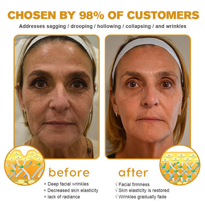 (✅MHRA Approved👩‍⚕️)-Furzero™ Botox Bee Venom Wrinkle Removal Cream-Last Day Promotion 70% OFF